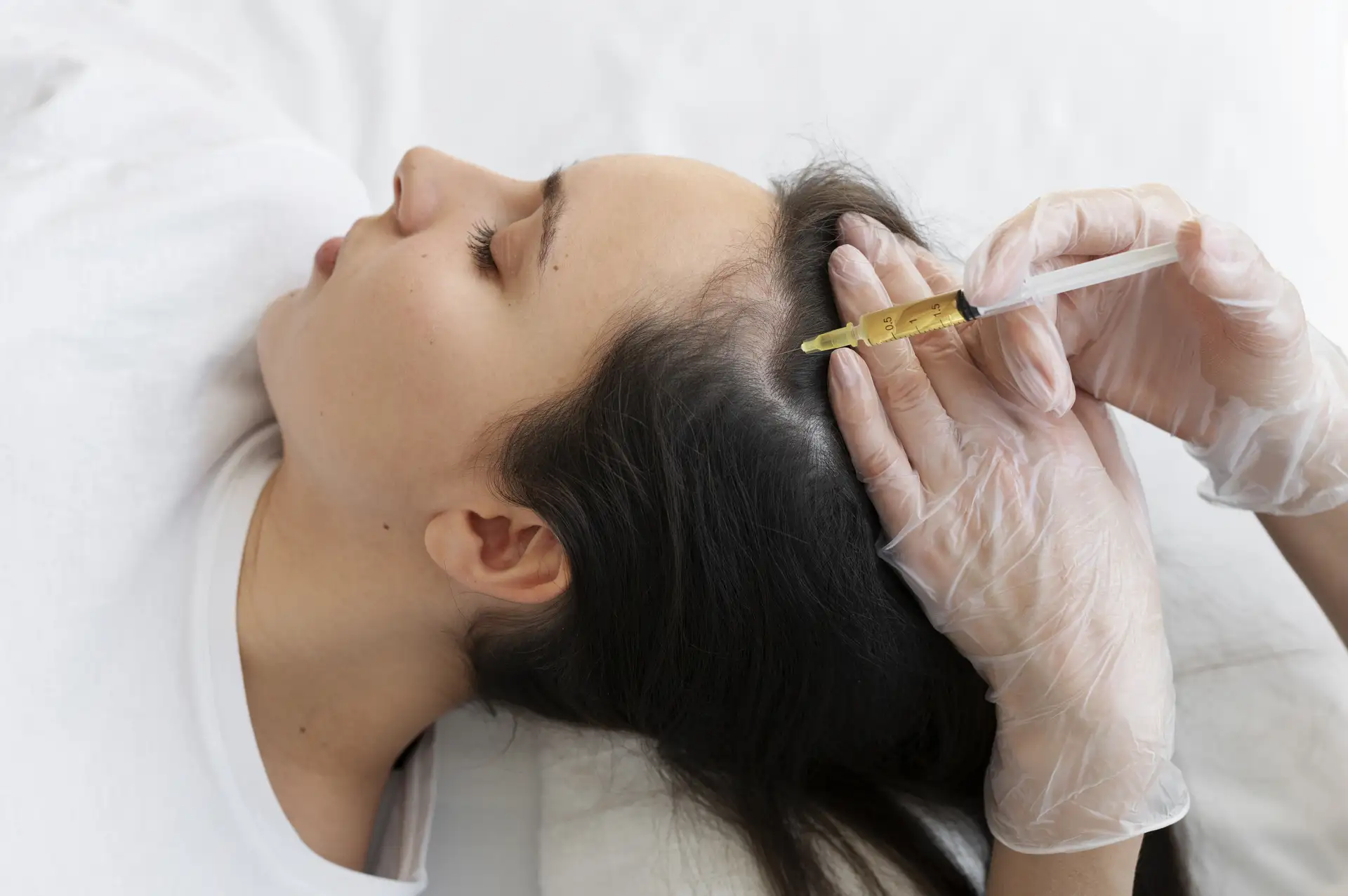 Gloved clinician injects platelet-rich plasma into a woman’s scalp to treat hair thinning.