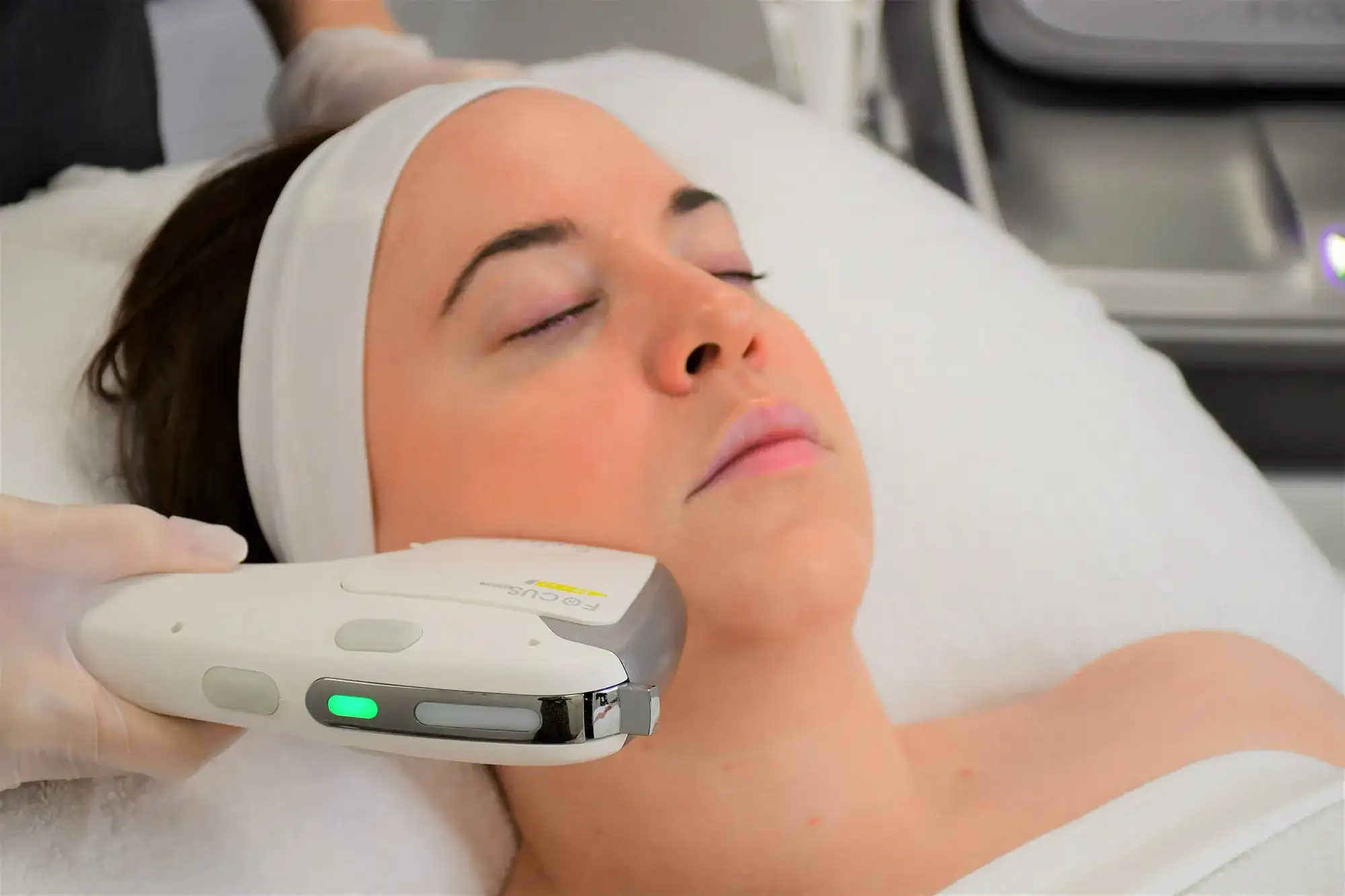 Close-up of a woman lying down with her eyes closed while a practitioner performs a HIFU treatment on her cheek using a handheld device.