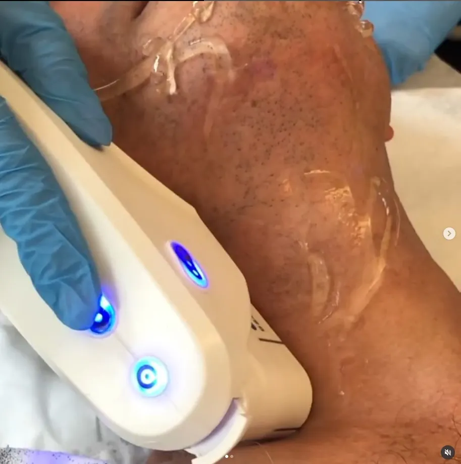 Customized Facial Treatments — Elegance Cosmetic Clinic Aesthetician performing a hydrating facial treatment on a client