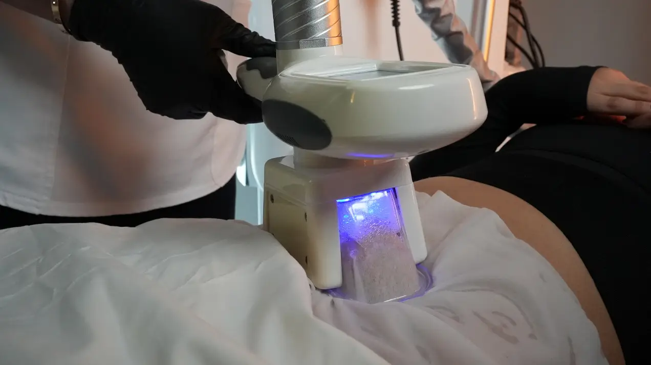 Close-up of cryolipolysis cooling applicator on a patient’s abdomen during a fat-freezing treatment, with blue light visible inside the device.