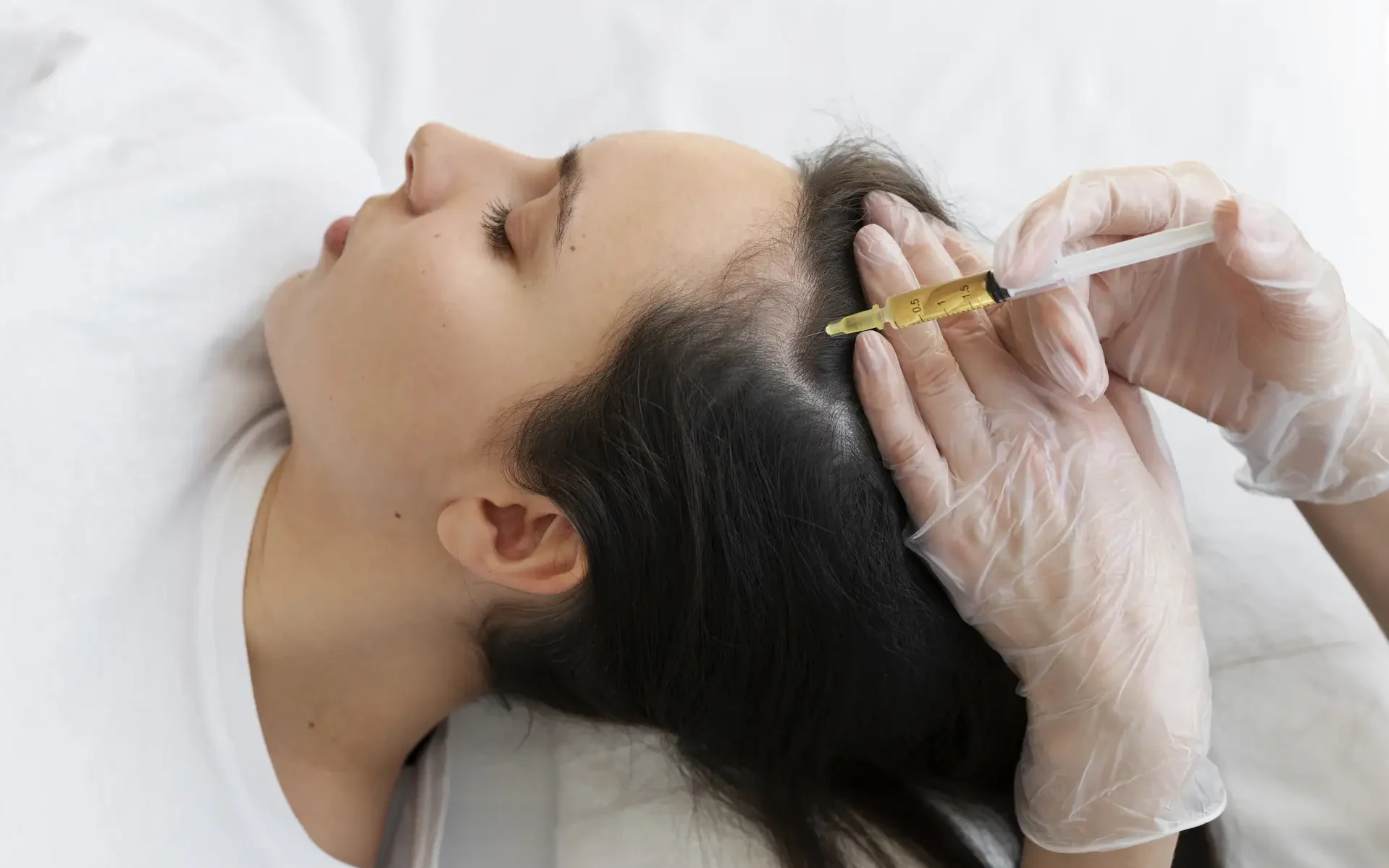 Gloved clinician injects platelet-rich plasma into a woman’s scalp to treat hair thinning.