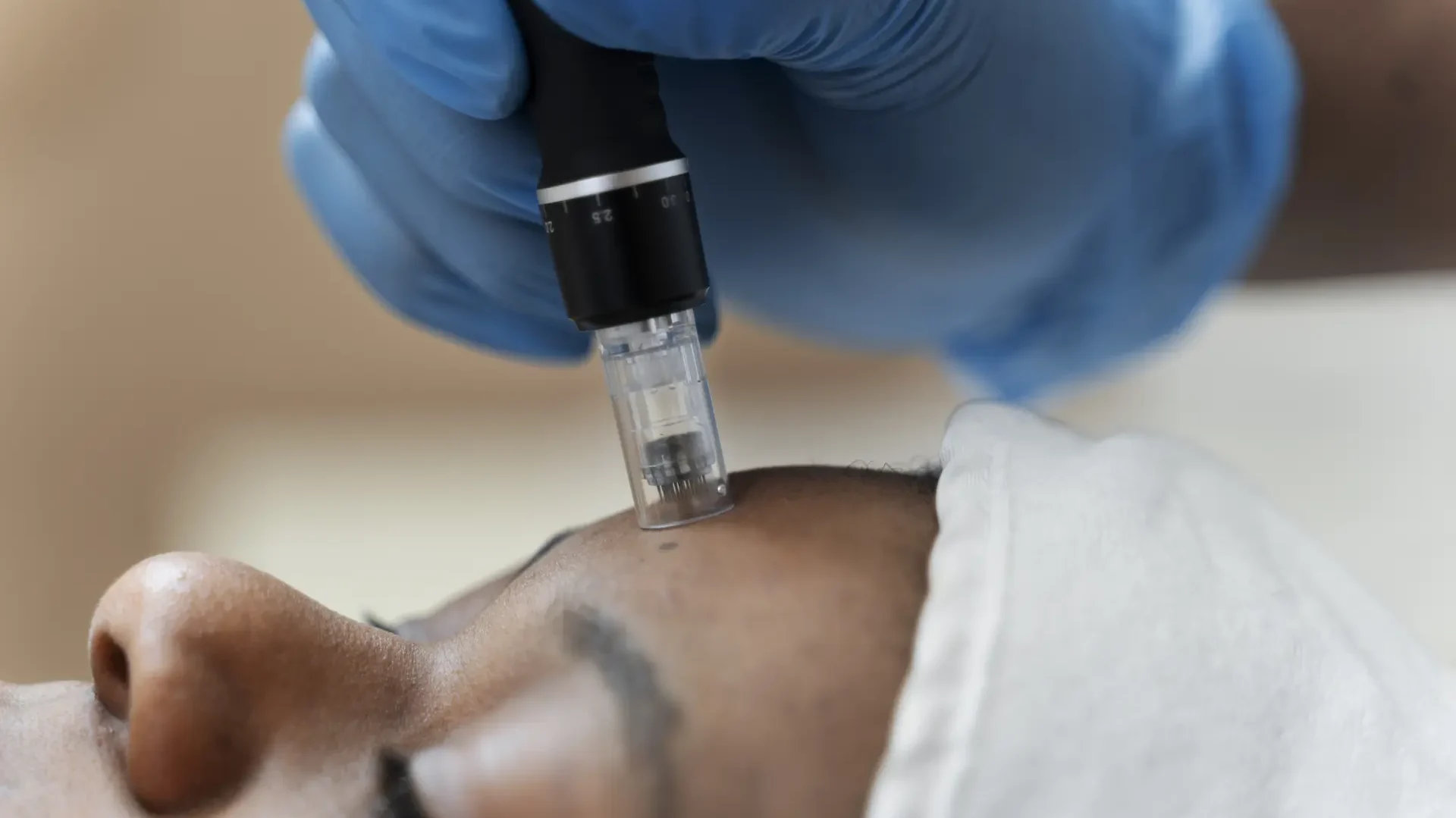 Hydrafacial Keravive Scalp Therapy